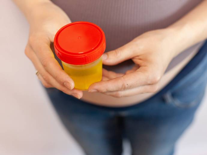 Ce que la couleur de votre urine dit de votre santé
