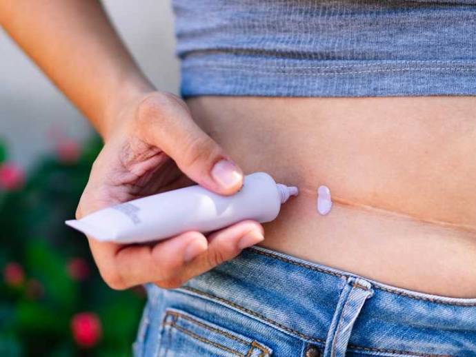 Évolution des cicatrices : comment les atténuer et favoriser leur guérison ?