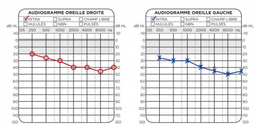 audiogramme