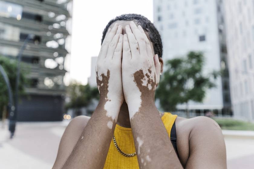 Femme se cachant le visage avec ses mains
